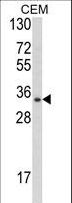 DPPA4 Antibody - Western blot of DPPA4 Antibody in CEM cell line lysates (35 ug/lane). DPPA4 (arrow) was detected using the purified antibody.