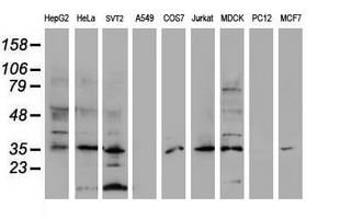 DPPA4 Antibody - Western blot of extracts (35ug) from 9 different cell lines by using anti-DPPA4 monoclonal antibody (HepG2: human; HeLa: human; SVT2: mouse; A549: human; COS7: monkey; Jurkat: human; MDCK: canine; PC12: rat; MCF7: human).