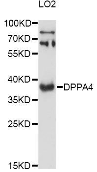 DPPA4 Antibody - Western blot analysis of extracts of LO2 cells, using DPPA4 antibody at 1:3000 dilution. The secondary antibody used was an HRP Goat Anti-Rabbit IgG (H+L) at 1:10000 dilution. Lysates were loaded 25ug per lane and 3% nonfat dry milk in TBST was used for blocking. An ECL Kit was used for detection and the exposure time was 90s.