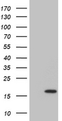 DPPA5 Antibody - HEK293T cells were transfected with the pCMV6-ENTRY control. (Left lane) or pCMV6-ENTRY DPPA5. (Right lane) cDNA for 48 hrs and lysed. Equivalent amounts of cell lysates. (5 ug per lane) were separated by SDS-PAGE and immunoblotted with anti-DPPA5. (1:2000)