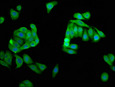 DPPA5 Antibody - Immunofluorescence staining of HepG2 cells at a dilution of 1:66, counter-stained with DAPI. The cells were fixed in 4% formaldehyde, permeabilized using 0.2% Triton X-100 and blocked in 10% normal Goat Serum. The cells were then incubated with the antibody overnight at 4°C.The secondary antibody was Alexa Fluor 488-congugated AffiniPure Goat Anti-Rabbit IgG (H+L) .