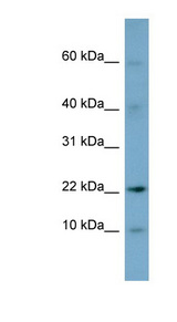 DPPA5 Antibody - DPPA5 antibody Western blot of PANC1 cell lysate. This image was taken for the unconjugated form of this product. Other forms have not been tested.