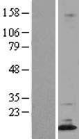 DPPA5 Protein - Western validation with an anti-DDK antibody * L: Control HEK293 lysate R: Over-expression lysate