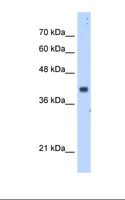 DPS / PDSS1 Antibody - HepG2 cell lysate. Antibody concentration: 5.0 ug/ml. Gel concentration: 12%.  This image was taken for the unconjugated form of this product. Other forms have not been tested.