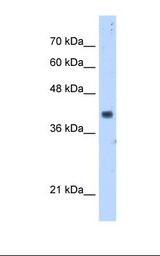 DPS / PDSS1 Antibody - HepG2 cell lysate. Antibody concentration: 5.0 ug/ml. Gel concentration: 12%.  This image was taken for the unconjugated form of this product. Other forms have not been tested.