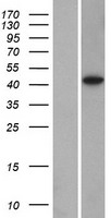 DPS / PDSS1 Protein - Western validation with an anti-DDK antibody * L: Control HEK293 lysate R: Over-expression lysate