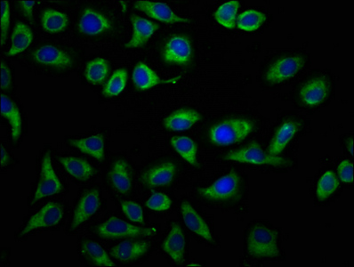 DPY19L1 Antibody - Immunofluorescence staining of A549 cells at a dilution of 1:166, counter-stained with DAPI. The cells were fixed in 4% formaldehyde, permeabilized using 0.2% Triton X-100 and blocked in 10% normal Goat Serum. The cells were then incubated with the antibody overnight at 4 °C.The secondary antibody was Alexa Fluor 488-congugated AffiniPure Goat Anti-Rabbit IgG (H+L) .