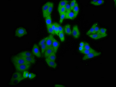 DPY19L3 Antibody - Immunofluorescence staining of HepG2 cells at a dilution of 1:200, counter-stained with DAPI. The cells were fixed in 4% formaldehyde, permeabilized using 0.2% Triton X-100 and blocked in 10% normal Goat Serum. The cells were then incubated with the antibody overnight at 4 °C.The secondary antibody was Alexa Fluor 488-congugated AffiniPure Goat Anti-Rabbit IgG (H+L) .