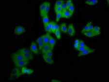 DPY19L3 Antibody - Immunofluorescence staining of HepG2 cells at a dilution of 1:200, counter-stained with DAPI. The cells were fixed in 4% formaldehyde, permeabilized using 0.2% Triton X-100 and blocked in 10% normal Goat Serum. The cells were then incubated with the antibody overnight at 4 °C.The secondary antibody was Alexa Fluor 488-congugated AffiniPure Goat Anti-Rabbit IgG (H+L) .