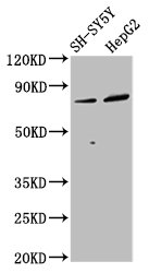 DPY19L3 Antibody - Positive Western Blot detected in SH-SY5Y whole cell lysate, HepG2 whole cell lysate. All lanes: DPY19L3 antibody at 3.4 µg/ml Secondary Goat polyclonal to rabbit IgG at 1/50000 dilution. Predicted band size: 84, 63 KDa. Observed band size: 84, 63 KDa