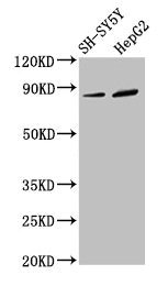 DPY19L3 Antibody - Western Blot Positive WB detected in: SH-SY5Y whole cell lysate, HepG2 whole cell lysate All lanes: DPY19L3 antibody at 3.4µg/ml Secondary Goat polyclonal to rabbit IgG at 1/50000 dilution Predicted band size: 84, 63 kDa Observed band size: 84 kDa