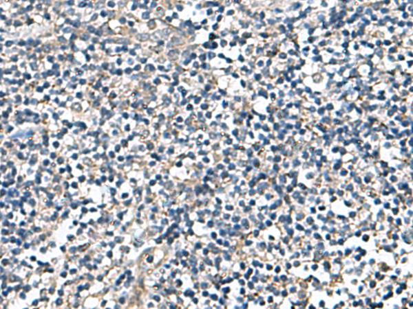 DPY19L3 Antibody - Immunohistochemistry of paraffin-embedded Human tonsil tissue  using DPY19L3 Polyclonal Antibody at dilution of 1:110(×200)