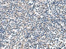 DPY19L3 Antibody - Immunohistochemistry of paraffin-embedded Human tonsil tissue  using DPY19L3 Polyclonal Antibody at dilution of 1:110(×200)