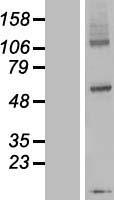 DPY19L3 Protein - Western validation with an anti-DDK antibody * L: Control HEK293 lysate R: Over-expression lysate