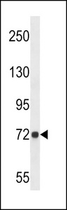 DPY19L4 Antibody - D19L4 Antibody western blot of A549 cell line lysates (35 ug/lane). The D19L4 antibody detected the D19L4 protein (arrow).