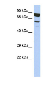 DPY19L4 Antibody - DPY19L4 antibody Western blot of Fetal Thymus lysate. This image was taken for the unconjugated form of this product. Other forms have not been tested.