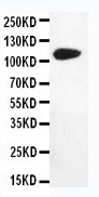 DPYD / DPD Antibody - WB of DPYD / DPD antibody. All lanes: Anti-DPYD at 0.5ug/ml. WB: MM231 Whole Cell Lysate at 40ug. Predicted bind size: 111KD. Observed bind size: 111KD.
