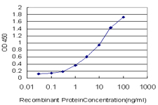 DPYD / DPD Antibody - Detection limit for recombinant GST tagged DPYD is approximately 0.1 ng/ml as a capture antibody.