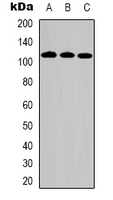 DPYD / DPD Antibody - Western blot analysis of DPD expression in HeLa (A); HepG2 (B); Jurkat (C) whole cell lysates.