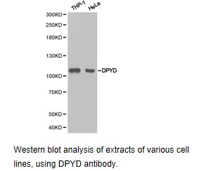 DPYD / DPD Antibody - Western blot.