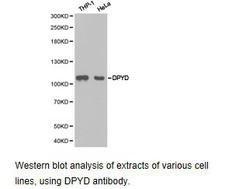 DPYD / DPD Antibody - Western blot.