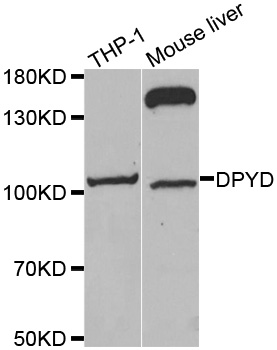 DPYD / DPD Antibody - Western blot analysis of extracts of various cell lines, using DPYD antibody.