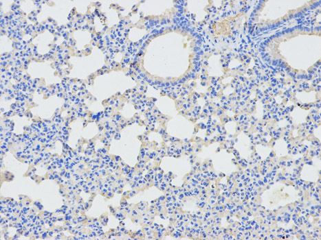 DPYD / DPD Antibody - Immunohistochemistry of paraffin-embedded mouse lung using DPYD antibody at dilution of 1:100 (200x lens).