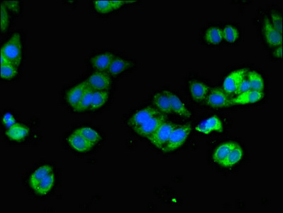 DPYD / DPD Antibody - Immunofluorescent analysis of HepG2 cells using DPYD Antibody at dilution of 1:100 and Alexa Fluor 488-congugated AffiniPure Goat Anti-Rabbit IgG(H+L)