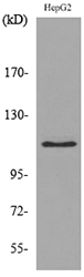 DPYD / DPD Antibody - Western blot analysis of lysate from HepG2 cells, using DPYD Antibody.