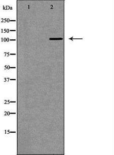 DPYD / DPD Antibody - Western blot analysis of HeLa whole cells lysates using DPYD antibody. The lane on the left is treated with the antigen-specific peptide.