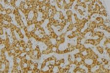 DPYD / DPD Antibody - 1:100 staining mouse liver tissue by IHC-P. The sample was formaldehyde fixed and a heat mediated antigen retrieval step in citrate buffer was performed. The sample was then blocked and incubated with the antibody for 1.5 hours at 22°C. An HRP conjugated goat anti-rabbit antibody was used as the secondary.