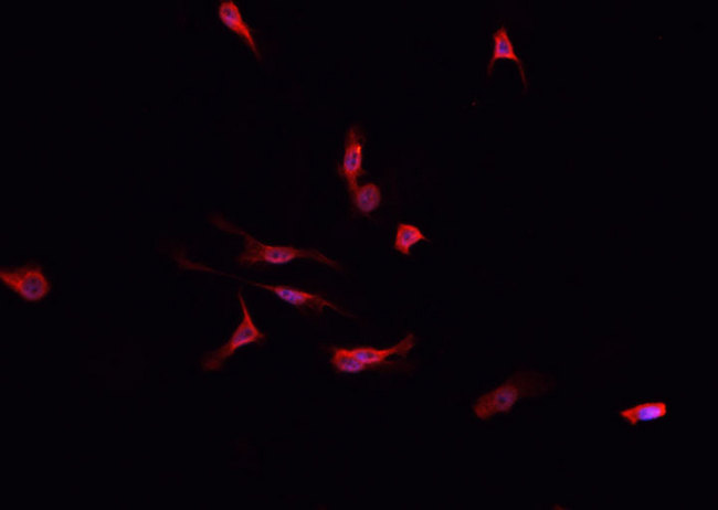 DPYD / DPD Antibody - Staining HepG2 cells by IF/ICC. The samples were fixed with PFA and permeabilized in 0.1% Triton X-100, then blocked in 10% serum for 45 min at 25°C. The primary antibody was diluted at 1:200 and incubated with the sample for 1 hour at 37°C. An Alexa Fluor 594 conjugated goat anti-rabbit IgG (H+L) antibody, diluted at 1/600, was used as secondary antibody.