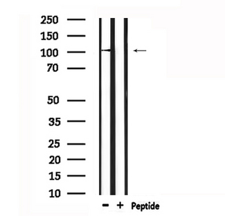 DPYD / DPD Antibody - Western blot analysis of extracts of mouse spleen using DPYD antibody.