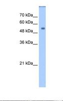 DPYS / Dihydropyrimidinase Antibody - Transfected 293T cell lysate. Antibody concentration: 1.25 ug/ml. Gel concentration: 12%.  This image was taken for the unconjugated form of this product. Other forms have not been tested.