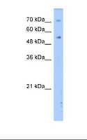 DPYS / Dihydropyrimidinase Antibody - Transfected 293T cell lysate. Antibody concentration: 2.5 ug/ml. Gel concentration: 12%.  This image was taken for the unconjugated form of this product. Other forms have not been tested.