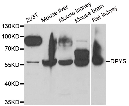 DPYS / Dihydropyrimidinase Antibody - Western blot analysis of extracts of various cell lines.