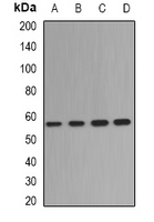 DPYS / Dihydropyrimidinase Antibody - Western blot analysis of Dihydropyrimidinase expression in HEK293T (A); mouse liver (B); mouse brain (C); rat kidney (D) whole cell lysates.
