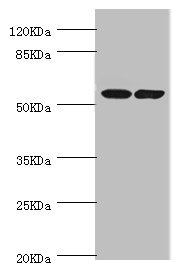 DPYS / Dihydropyrimidinase Antibody - Western blot All Lanes:DPYS antibody at 1.1ug/ml Lane 1:mouse liver tissue Lane 2:mouse kidney tissue Secondary Goat polyclonal to rabbit at 1/10000 dilution Predicted band size: 57kDa Observed band size: 57kDa