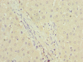 DPYS / Dihydropyrimidinase Antibody - Immunohistochemistry of paraffin-embedded human liver tissue at dilution 1:100