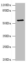 DPYS / Dihydropyrimidinase Antibody - Western blot All Lanes:DPYS antibody at 1.34ug/ml+Mouse liver tissue Secondary Goat polyclonal to rabbit at 1/10000 dilution Predicted band size: 57kDa Observed band size: 57kDa