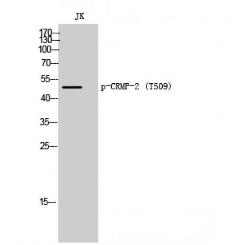 DPYSL2 / CRMP2 Antibody - Western blot of Phospho-CRMP-2 (T509) antibody