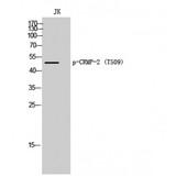 DPYSL2 / CRMP2 Antibody - Western blot of Phospho-CRMP-2 (T509) antibody