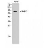 DPYSL2 / CRMP2 Antibody - Western blot of CRMP-2 antibody