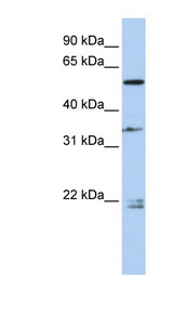 DPYSL2 / CRMP2 Antibody - DPYSL2 / CRMP2 antibody Western blot of Fetal Brain lysate. This image was taken for the unconjugated form of this product. Other forms have not been tested.