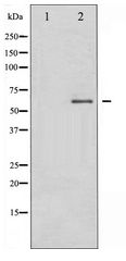 DPYSL2 / CRMP2 Antibody - Western blot of DRP-2 expression in EGF treated A549 whole cell lysates,The lane on the left is treated with the antigen-specific peptide.