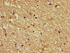 DPYSL2 / CRMP2 Antibody - Immunohistochemistry image of paraffin-embedded human brain tissue at a dilution of 1:100