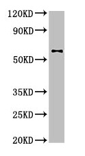 DPYSL2 / CRMP2 Antibody - Western Blot Positive WB detected in: U87 whole cell lysate All lanes: DPYSL2 antibody at 4µg/ml Secondary Goat polyclonal to rabbit IgG at 1/50000 dilution Predicted band size: 63, 59 kDa Observed band size: 63 kDa