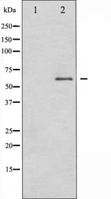 DPYSL2 / CRMP2 Antibody - Western blot analysis of DRP-2 expression in EGF treated A549 whole cells lysates. The lane on the left is treated with the antigen-specific peptide.