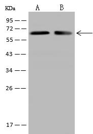 DPYSL2 / CRMP2 Antibody - Anti-DPYSL2 rabbit polyclonal antibody at 1:500 dilution. Lane A: Jurkat Whole Cell Lysate. Lane B: U87MG Whole Cell Lysate. Lysates/proteins at 30 ug per lane. Secondary: Goat Anti-Rabbit IgG (H+L)/HRP at 1/10000 dilution. Developed using the ECL technique. Performed under reducing conditions. Predicted band size: 62 kDa. Observed band size: 62 kDa.