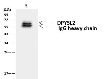 DPYSL2 / CRMP2 Antibody - DPYSL2 was immunoprecipitated using: Lane A: 0.5 mg Jurkat Whole Cell Lysate. 4 uL anti-DPYSL2 rabbit polyclonal antibody and 60 ug of Immunomagnetic beads Protein A/G. Primary antibody: Anti-DPYSL2 rabbit polyclonal antibody, at 1:100 dilution. Secondary antibody: Goat Anti-Rabbit IgG (H+L)/HRP at 1/10000 dilution. Developed using the ECL technique. Performed under reducing conditions. Predicted band size: 62 kDa. Observed band size: 62 kDa.
